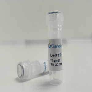 人源 FTO 野生型过表达慢病毒质粒