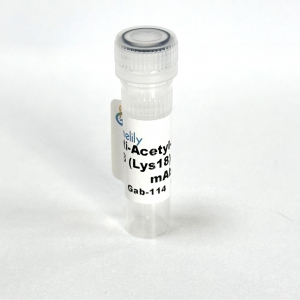 Anti-Acetyl-Histone H3 (Lys18) Rabbit mAb